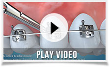 clever-orthodontics-play-video-01