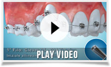 clever-orthodontics-play-video-02