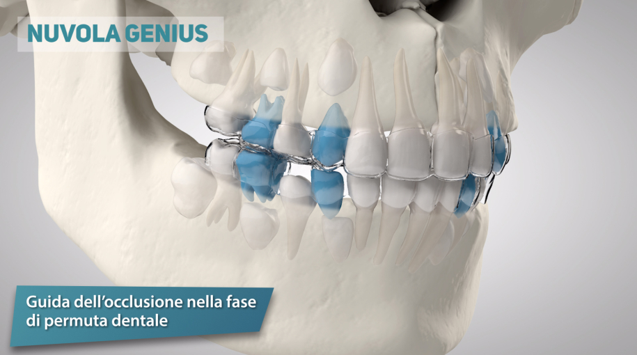 Caso Studio: Video in Animazione 3D per Allineatori Dentali