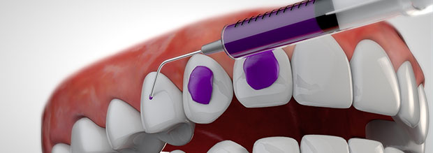 3d-odontotecnico-protesi-dentaria-rendering-video