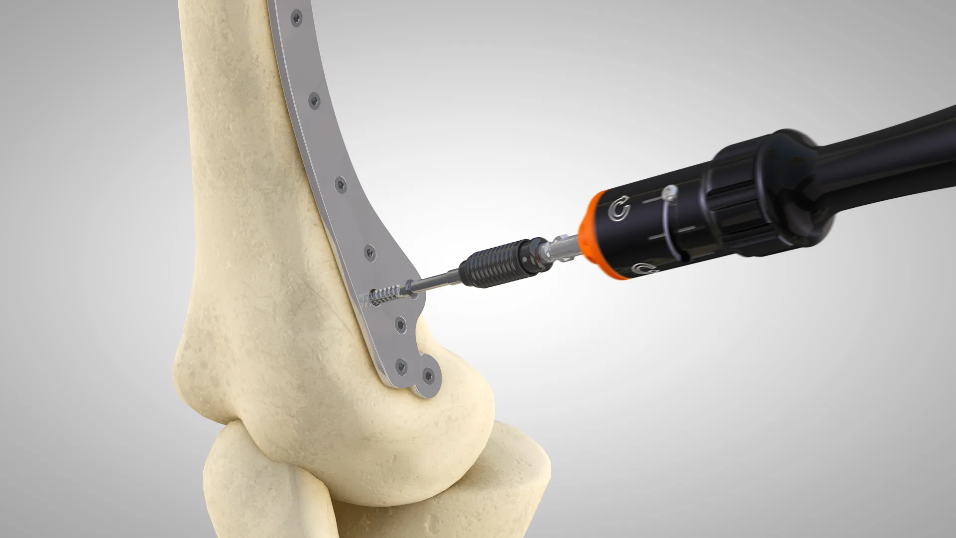 Animazione 3D di un cacciavite medicale