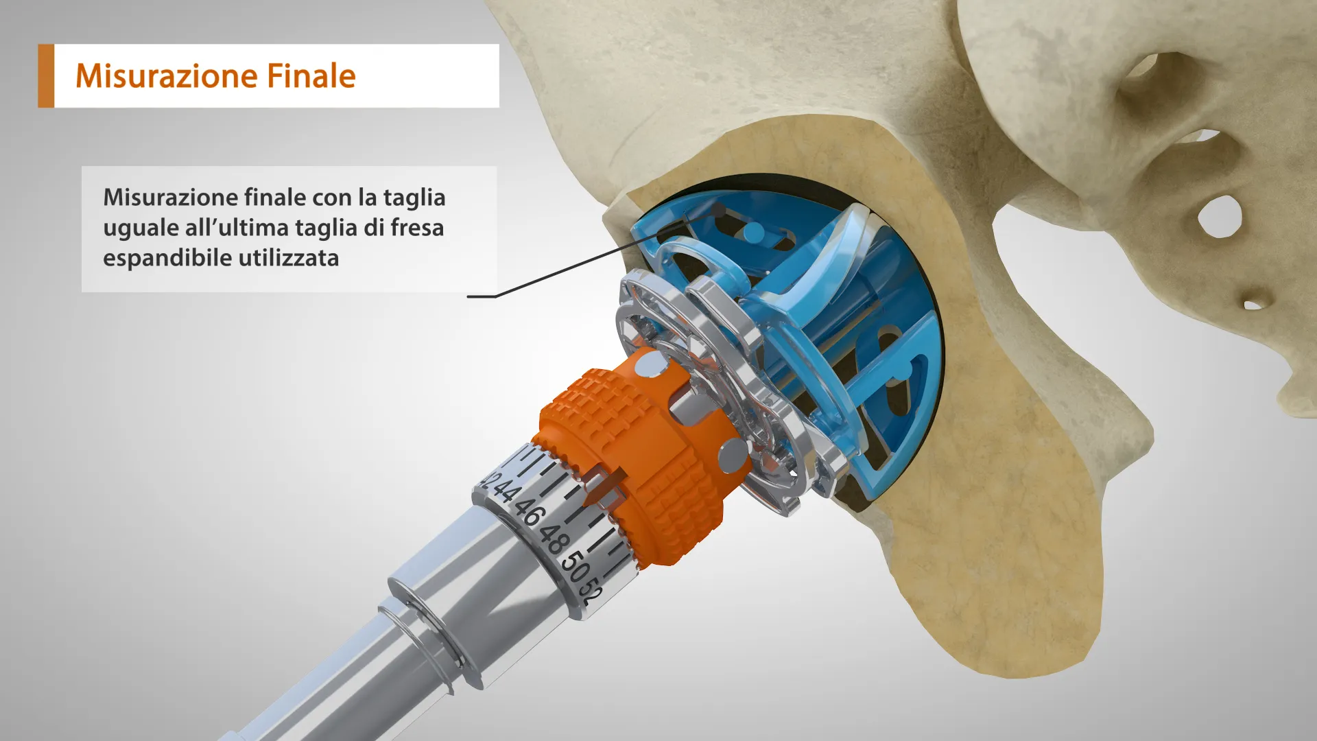 Video 3D di una fresa per protesi ortopediche