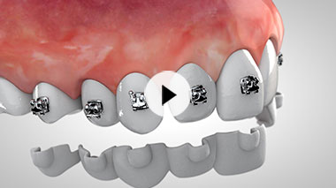 video-animazione-3d-laboratorio-ortodontico