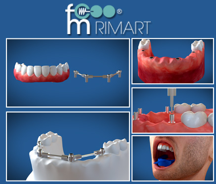 video-dentista-rizzo-articolo