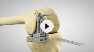 Bioimpianti-video-3d-k-mono