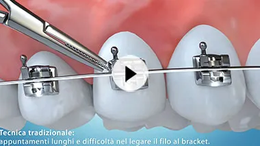 clever-orthodontics-video-02