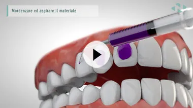 video-3d-Attachments